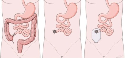 314990_1_En_14_Fig22_HTML